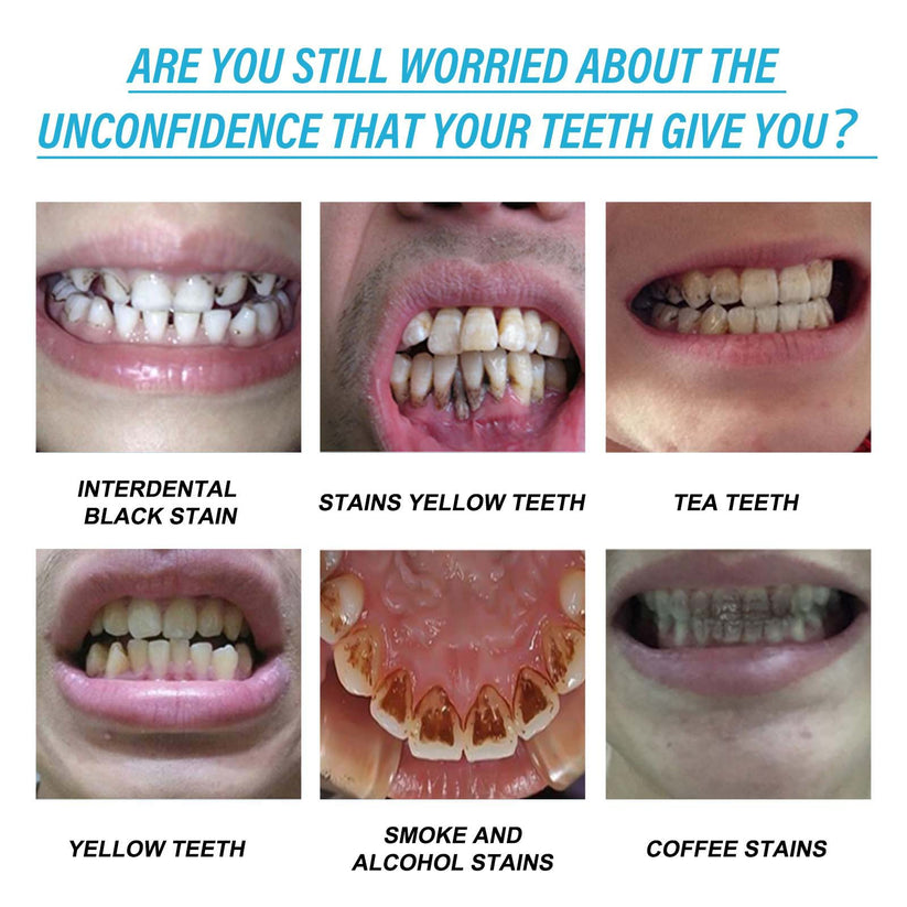 Yellow teeth, stains, gum problems, bad breath