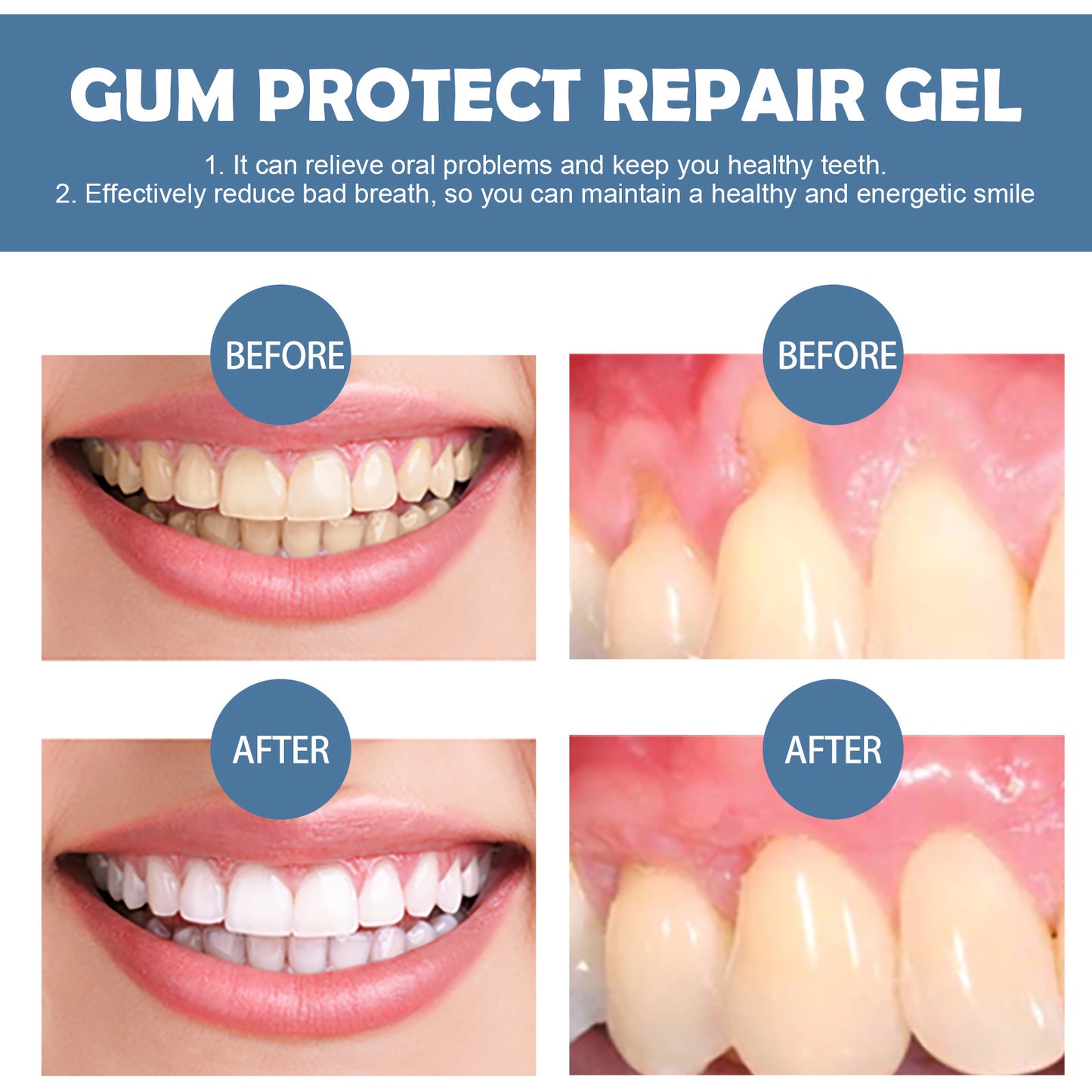 Meowvra🔔Gum Repair gel➡Deep cleaning of teeth,Care for Gums,Fresh Breath