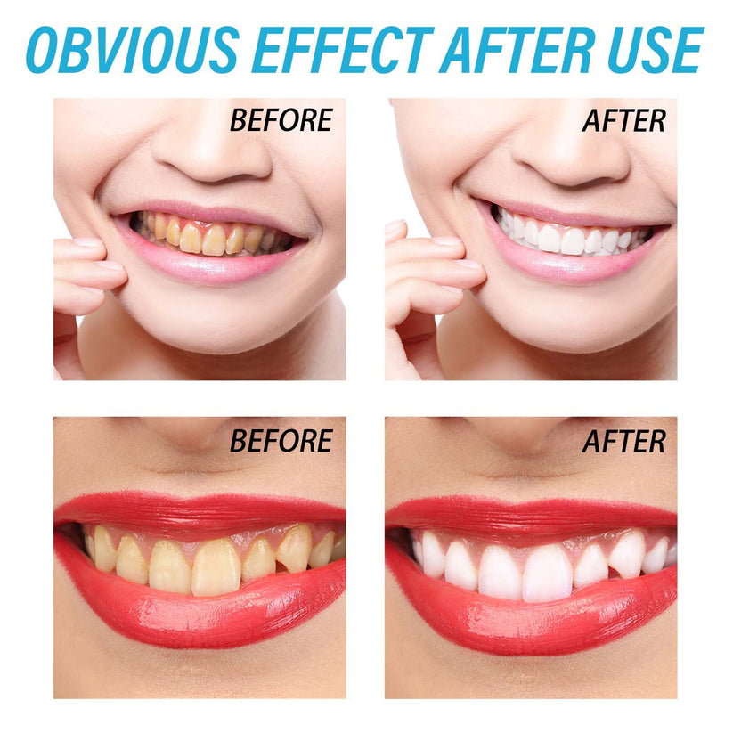Before and after teeth effect